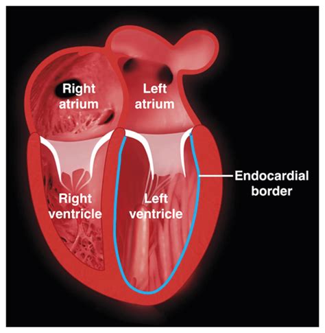 impaired left ventricular systolic function